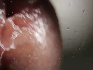 Thư phĩm xx giãn.